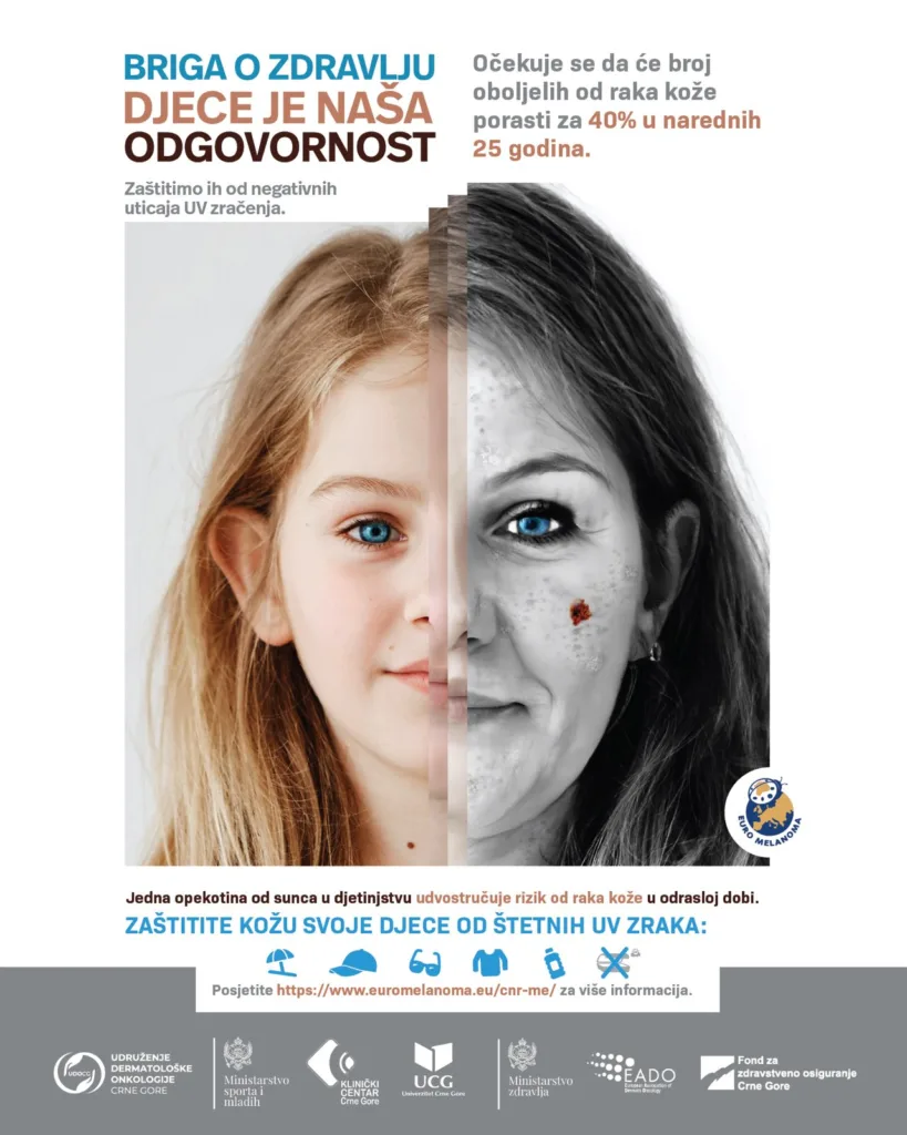 Besplatni dermatološki pregledi u 12 opština: Prevencija je ključ zdravlja kože